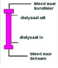 figuur-hemodialyse2